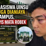 Mahasiswa UINSU diduga dianiaya di kampus hingga pelipis mata robek